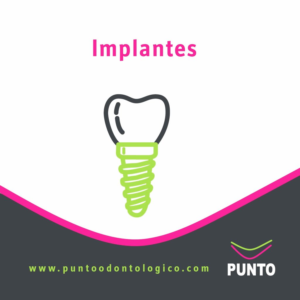Implantes dentales Montevideo - Punto Odontológico