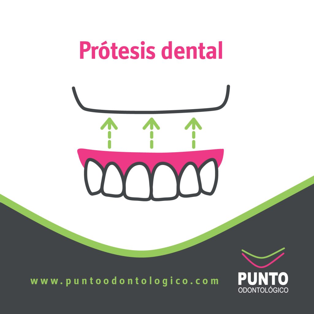 Prótesis dental PUNTO